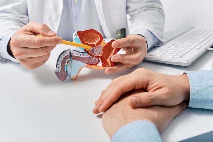 Dr showing male bph patient model of prostate