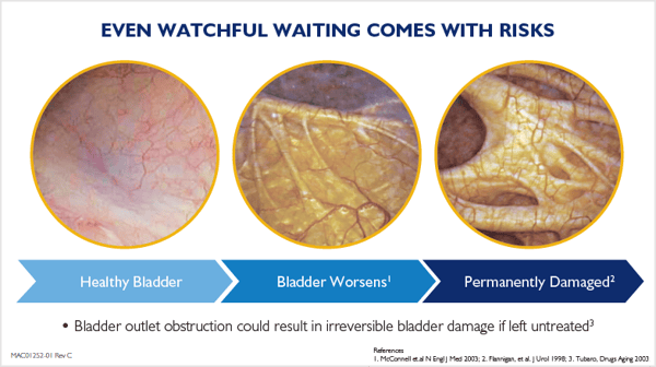 watchful waiting risks - bladder